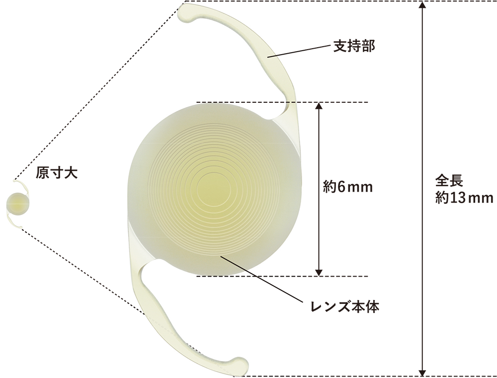 眼内レンズ