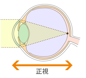 正視